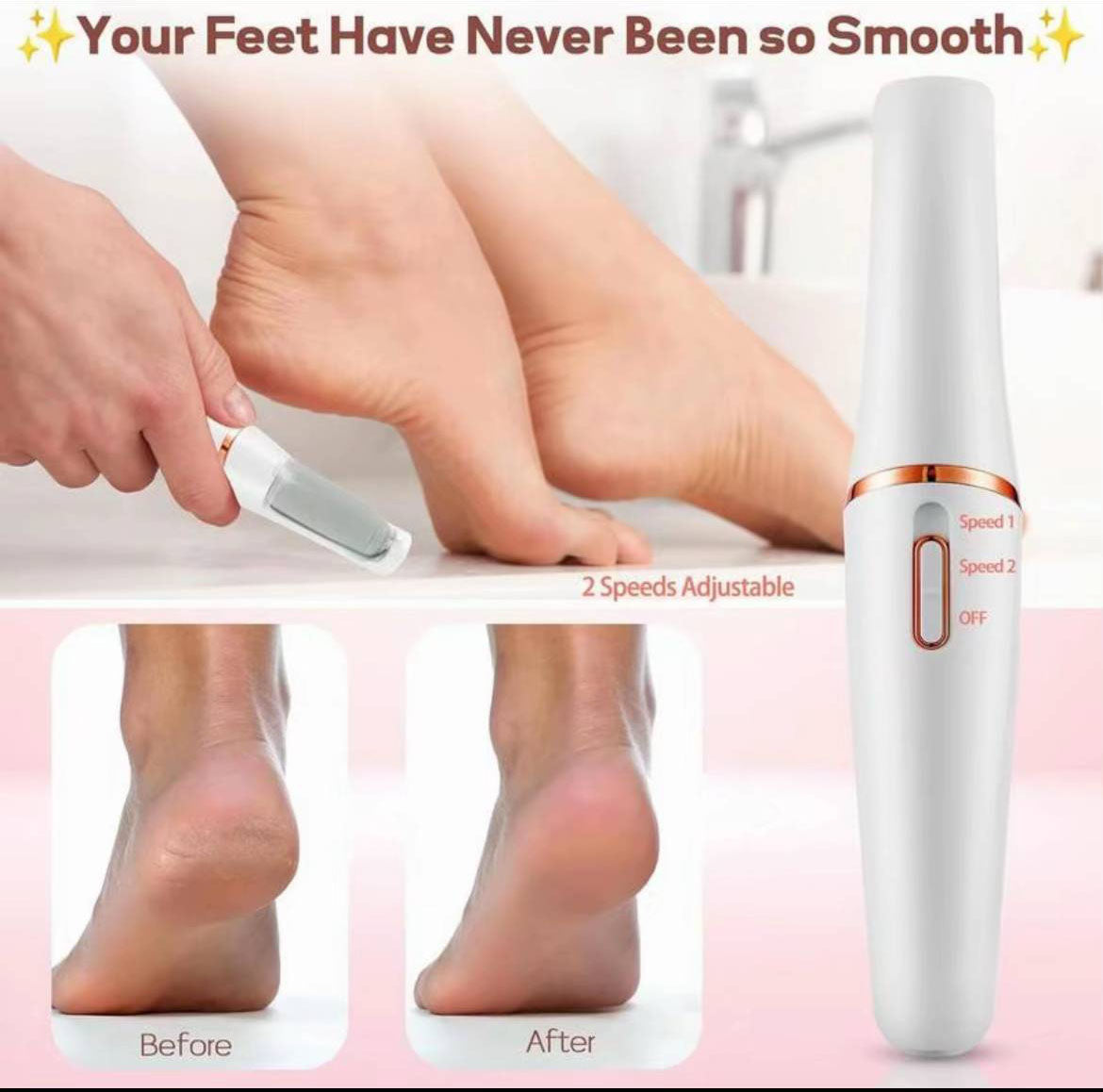 Callus Remover kit